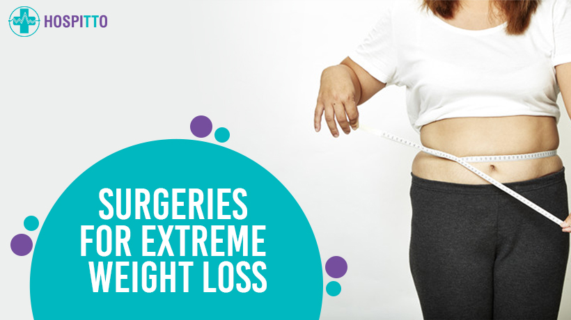 surgeries for weight loss